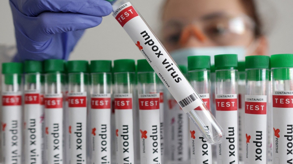 Guinea-Bissau Confirms First Mpox Case as Health Authorities Launch Disease Response