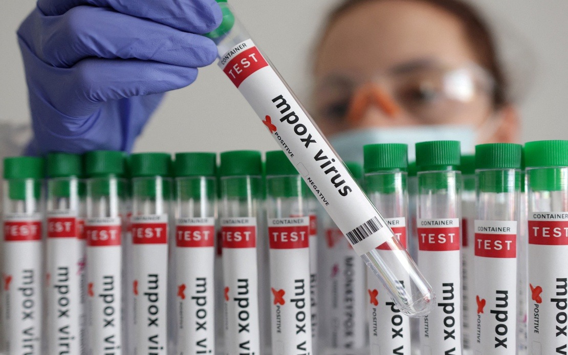 Guinea-Bissau Confirms First Mpox Case as Health Authorities Launch Disease Response