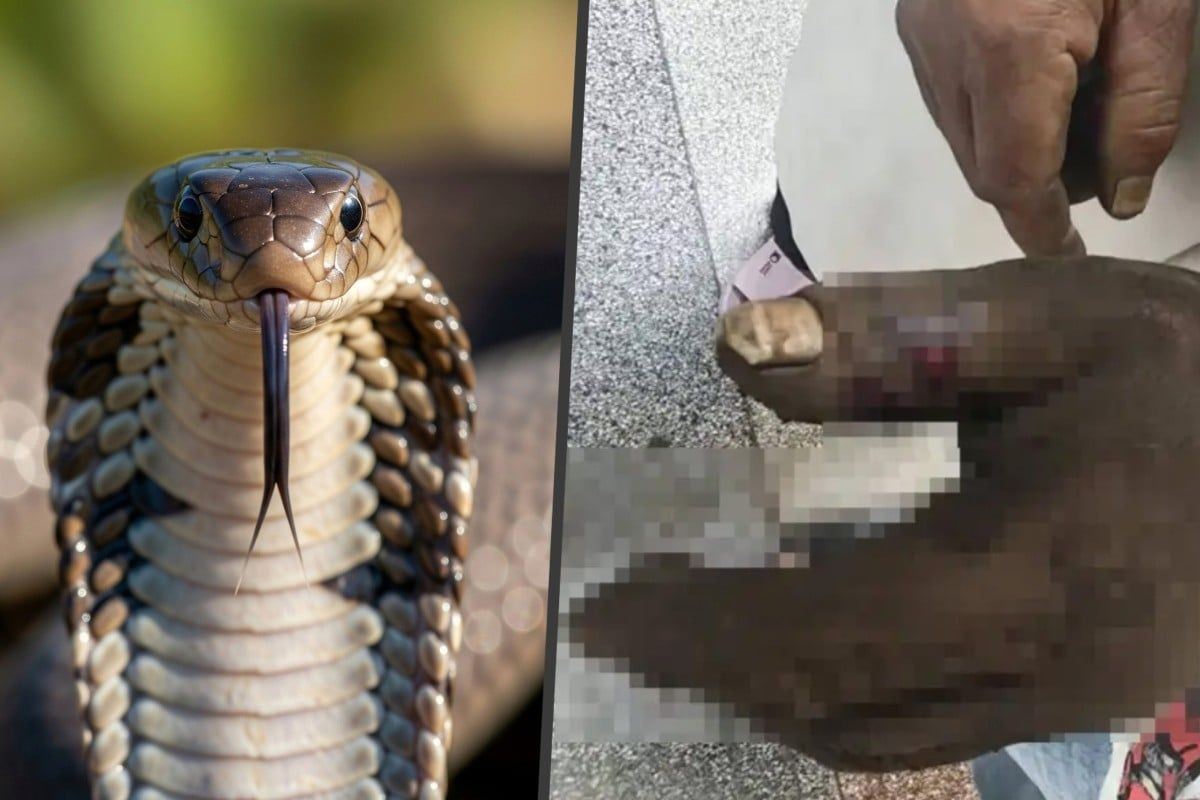 Chinese Woman Poisons Herself Attempting TV-Inspired Snake Bite Rescue