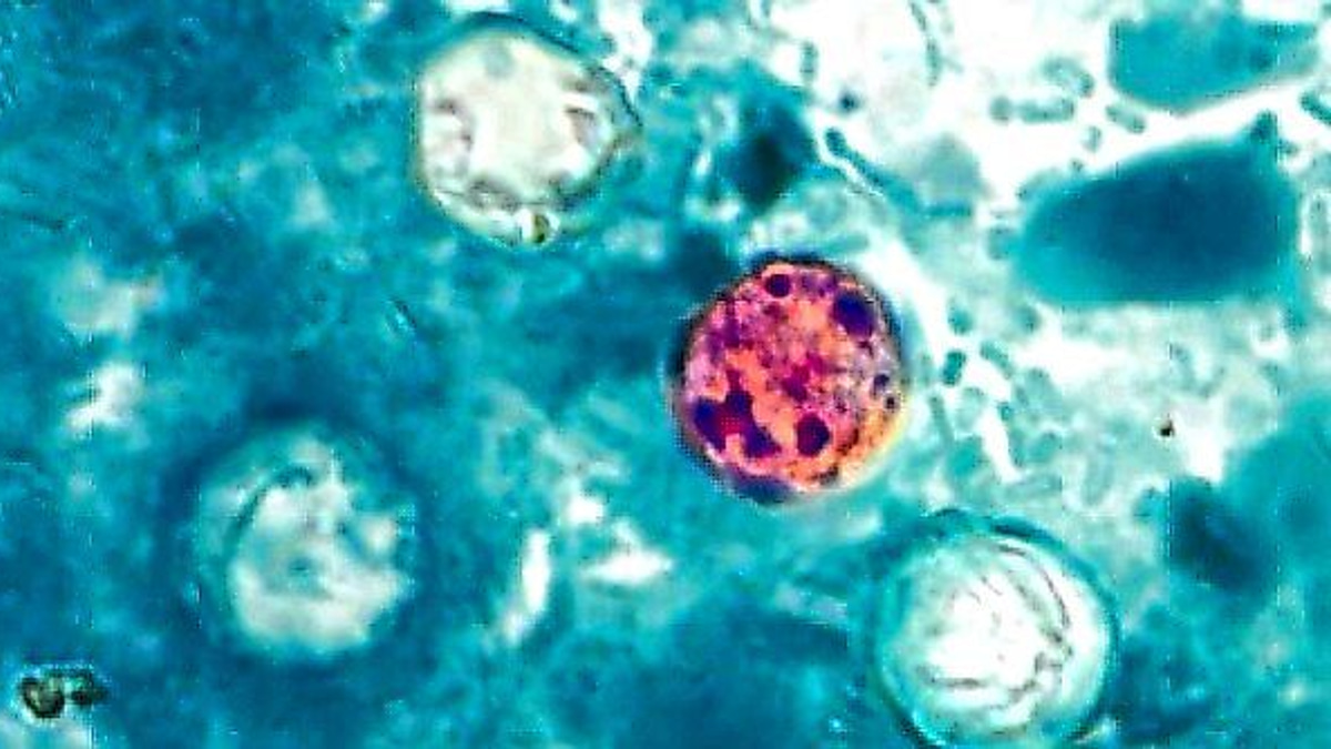The Hidden Parasite: Why Cyclospora Outbreaks Slip Through Global Food Safety Networks