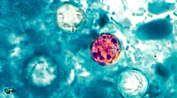 The Hidden Parasite: Why Cyclospora Outbreaks Slip Through Global Food Safety Networks