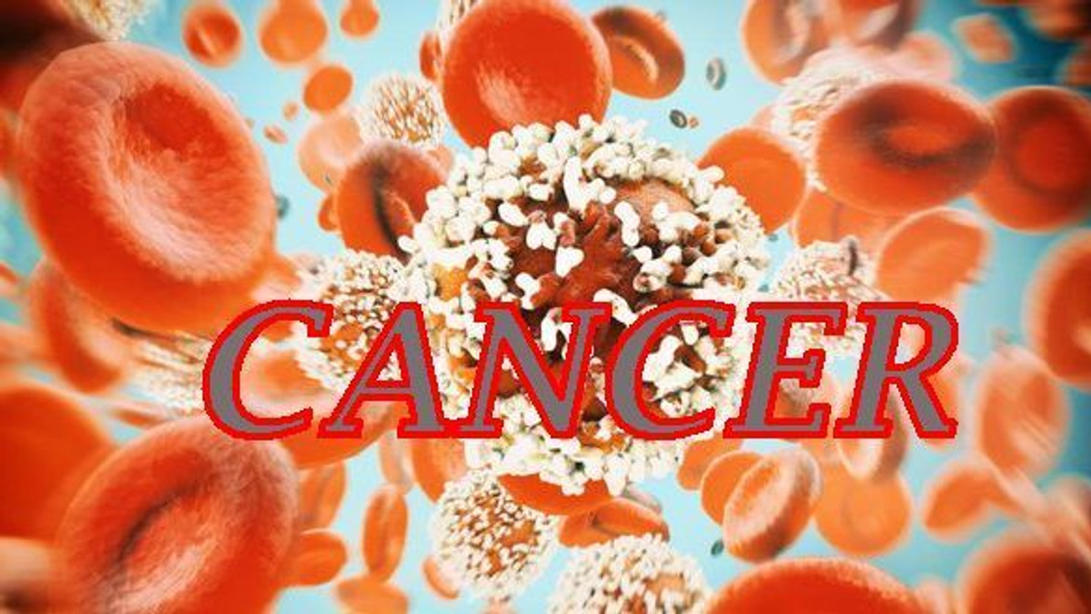 The Rising Scourge of Early-Onset Colorectal Cancer Among Young People