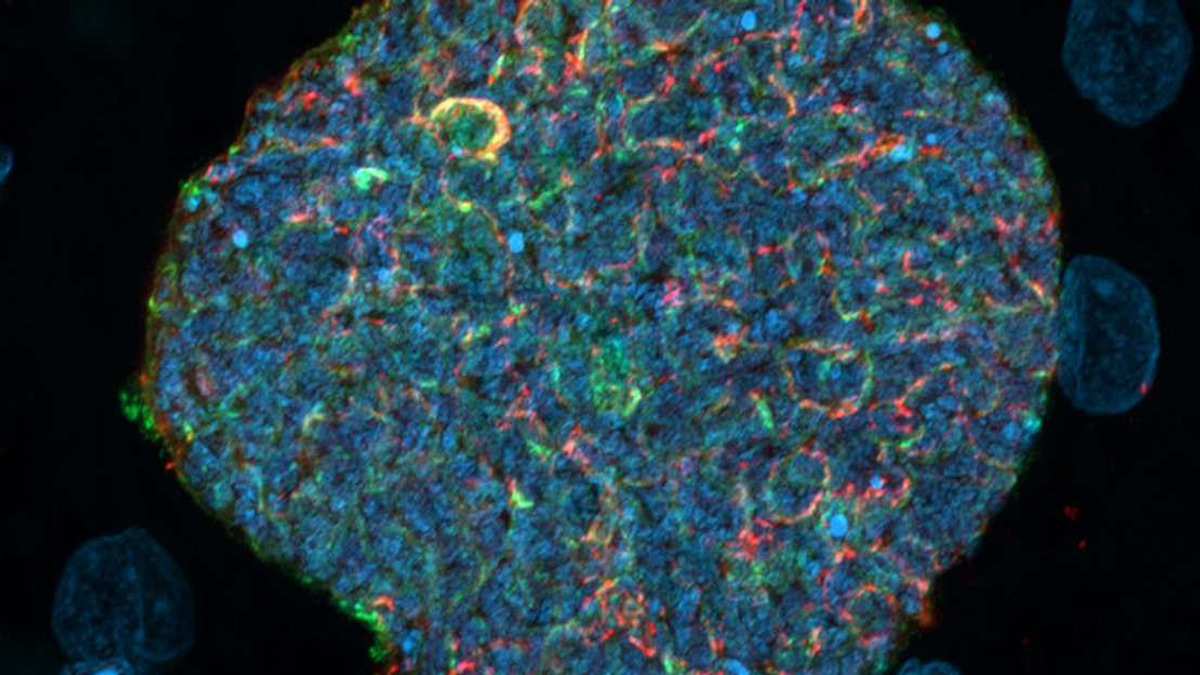 Australian Researchers Develop Novel Malaria Vaccine Strategy Using Mosquito Bites as Natural Boosters