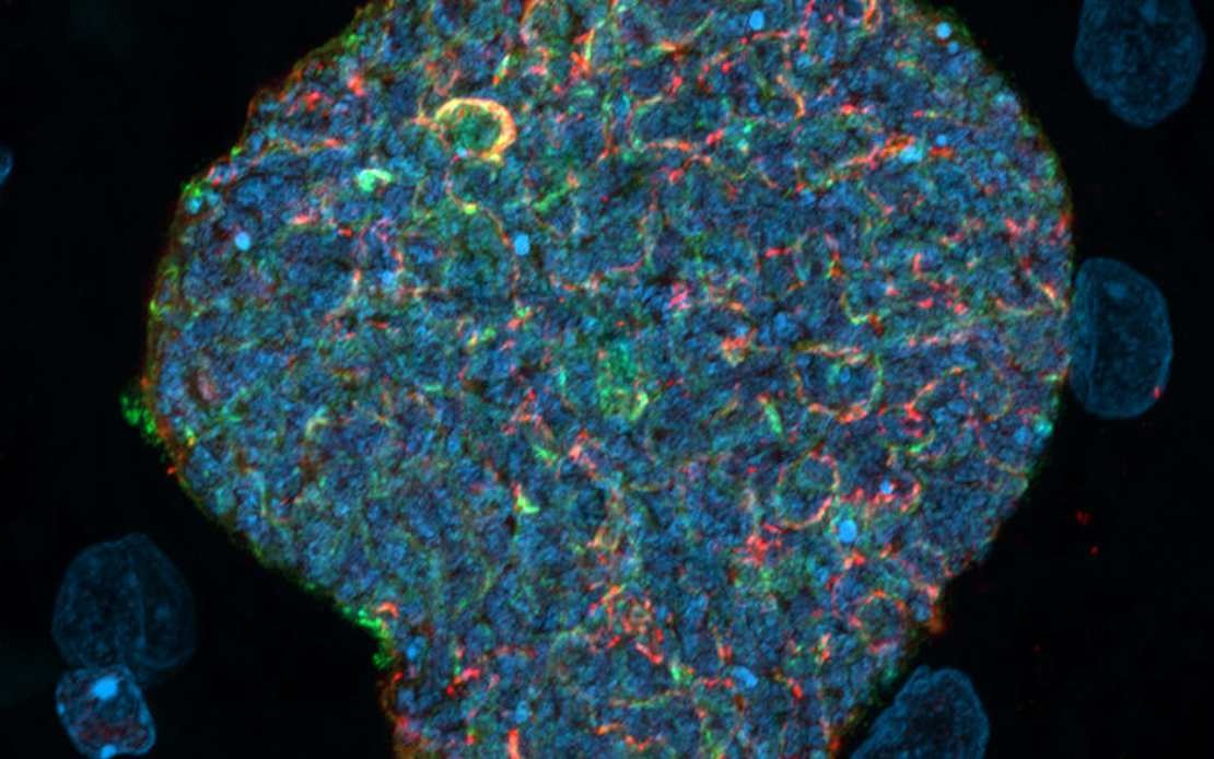 Australian Researchers Develop Novel Malaria Vaccine Strategy Using Mosquito Bites as Natural Boosters