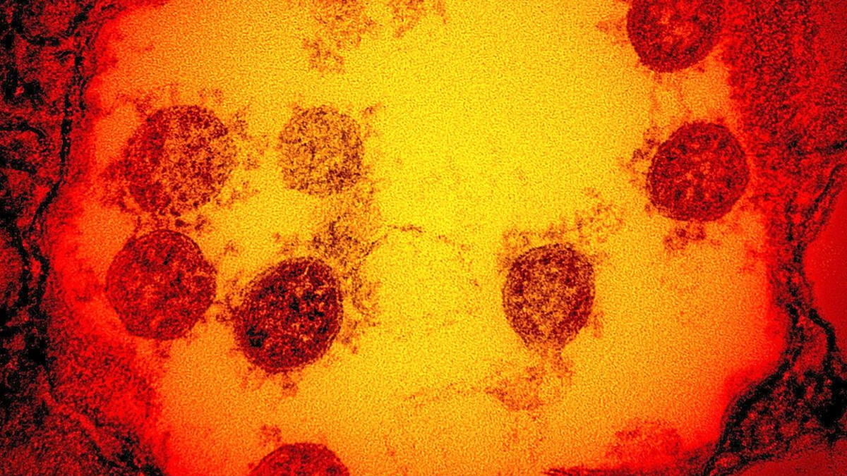 Cambridge scientists develop 'master key' vaccine technology to combat viral families