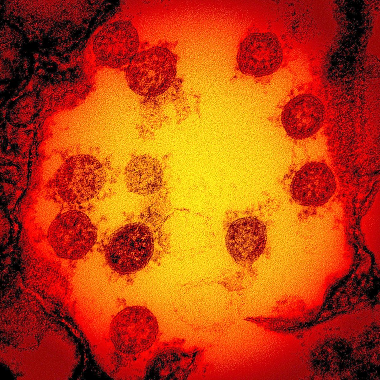 Cambridge scientists develop 'master key' vaccine technology to combat viral families